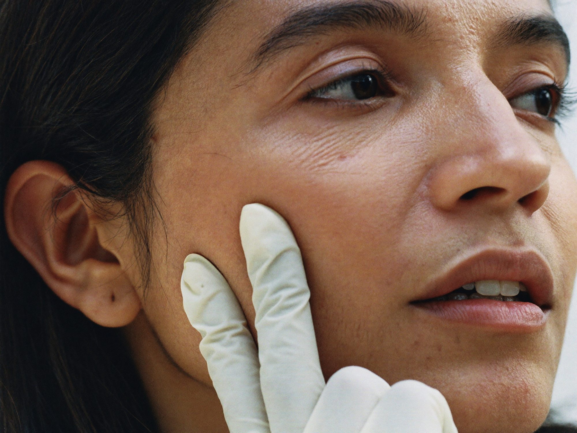 A gloved hand resting on a woman's cheekbone while the skin under her eye is assessed