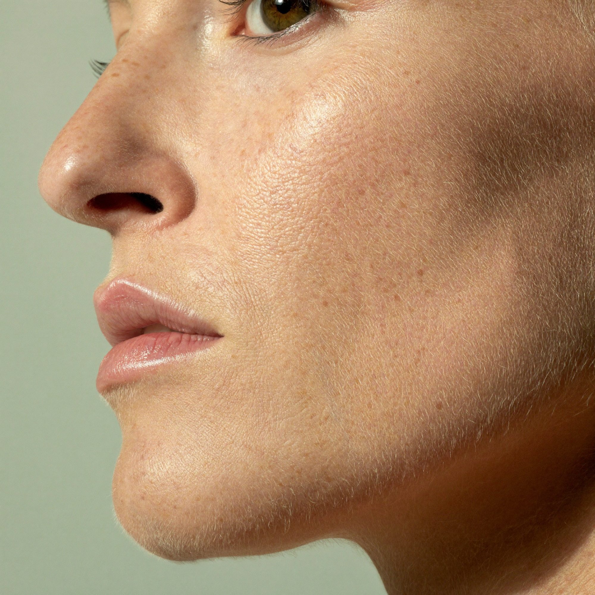 Close-up profile of freckled skin